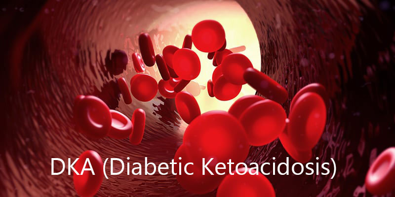 Hyperglycemia with acidic blood